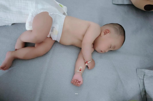 兰考宝宝脸上有白色斑块